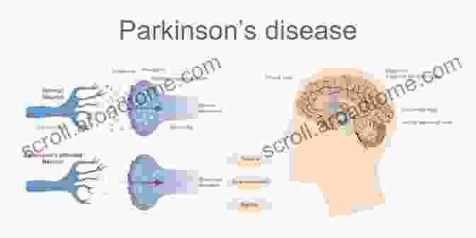 Diagram Illustrating The Role Of Redox Signaling In Parkinson's Disease Oxidative Stress And Redox Signalling In Parkinsons Disease (ISSN 34)