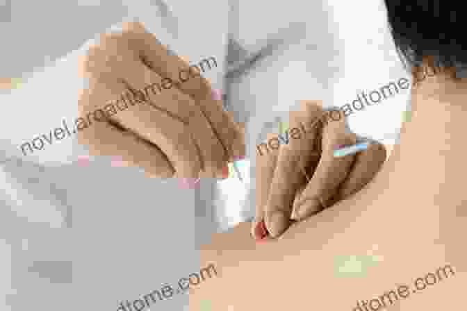 Image Of A Person Receiving Acupuncture Positive Options For Hiatus Hernia: Self Help And Treatment (Positive Options For Health)