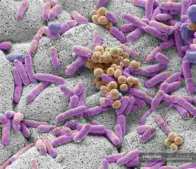 Microscopic View Of Bacteria Don T Step On The Ant : Why Insects And Bugs Are Important (Love Bugs Animals 1)