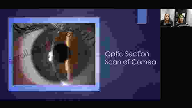 Ocular Structures Illuminated By The Slit Lamp Beam, Revealing Intricate Details Of The Eye's Anatomy. MANUAL ON SLIT LAMP BIOMICROSCOPY: A STEP BY STEP GUIDE TO SLIT LAMP BIOMICROSCOPY