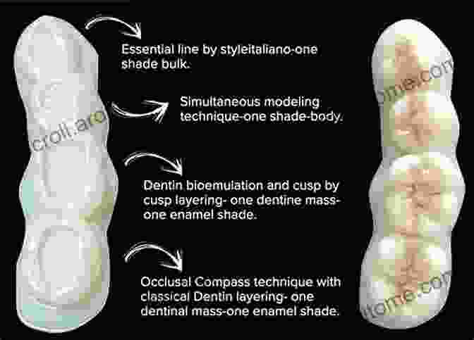 Techniques For Restoring Tooth Structure Basic Guide To Dental Materials (Basic Guide Dentistry Series)