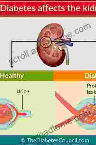 Kidney and Hypertension in Diabetes Mellitus