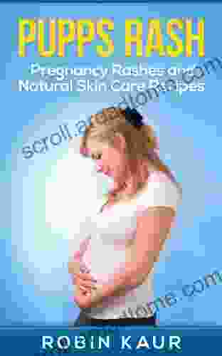 Pupps Rash: Pregnancy Rashes And Natural Skin Care Recipes (Skin Rashes During Pregnancy Motherhood Pupps Treatment)