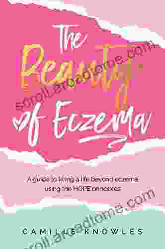 The Beauty Of Eczema: A Guide To Living A Life Beyond Eczema Using The Hope Principles