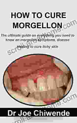 HOW TO CURE MORGELLON: The Ultimate Guide On Everything You Need To Know On Morgellon Symptoms Disease Healing To Cure Itchy Skin