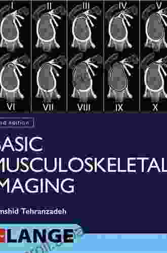 Basic Musculoskeletal Imaging Second Edition